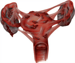uterus