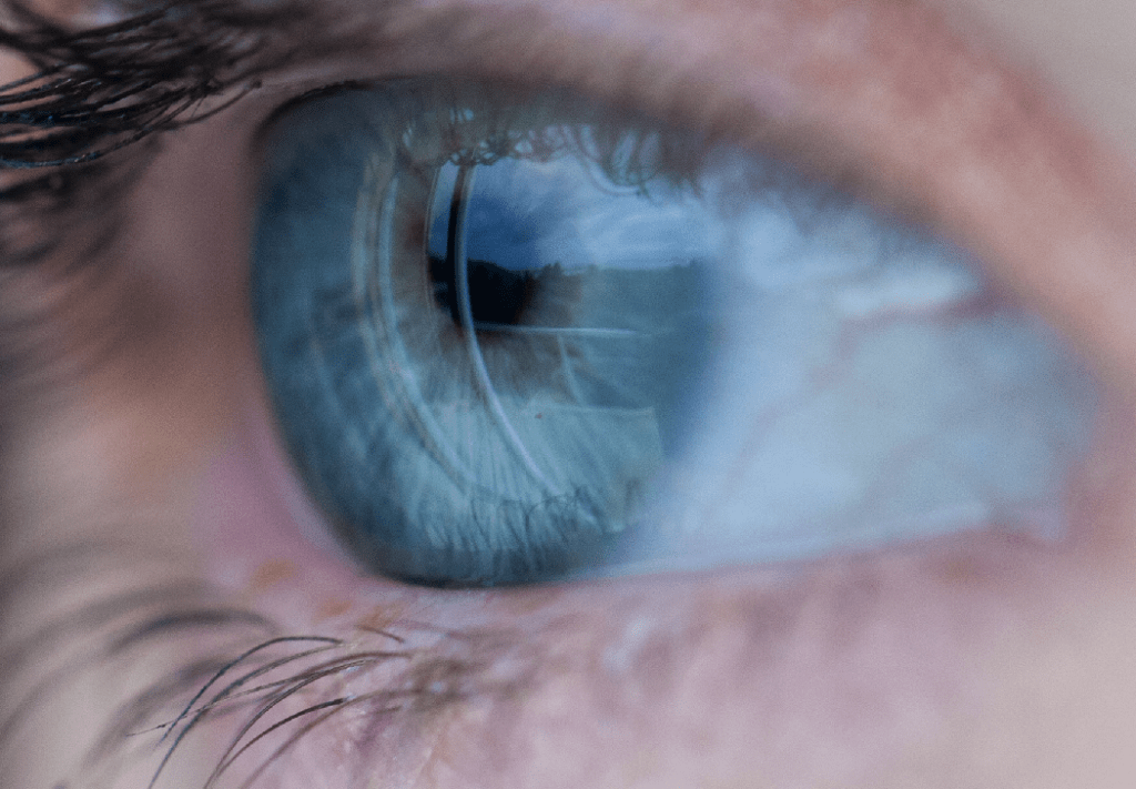 He’d Expected to See Some Blood – by Steve&nbsp;Campbell